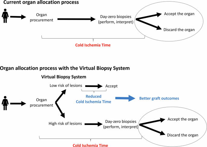 Reply to: Machine learning-driven virtual biopsy system may increase organ discards at aggressive kidney transplant centers